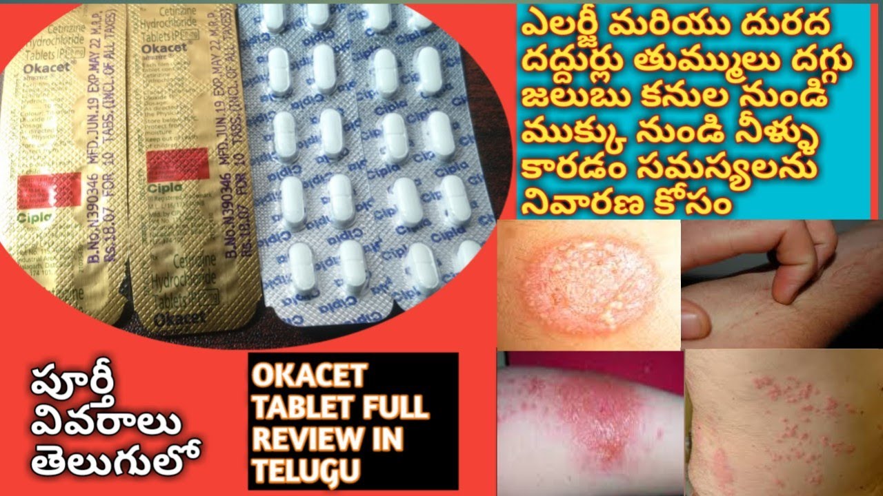 OKACET TABLET FULL REVIEW IN TELUGU ALLERGY ITCHING RUNNING NOSE WATERY EYES COLD COUGH SNEEZING