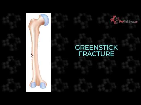 Types of fracture training -  video | ProFirstAid