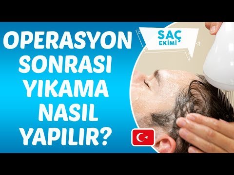Saç Ekimi operasyonu sonrası yıkama nasıl yapılır? - Dr. Hamid AYDIN