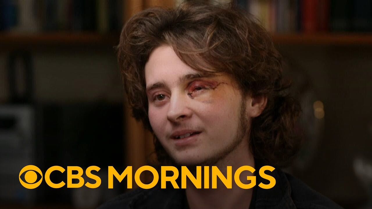 Protester says he's blind in one eye after federal agent fired less-lethal round at his face