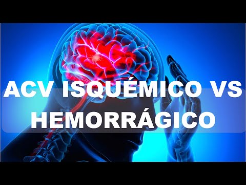 ACV Isquémico vs Hemorrágico. Diferencias