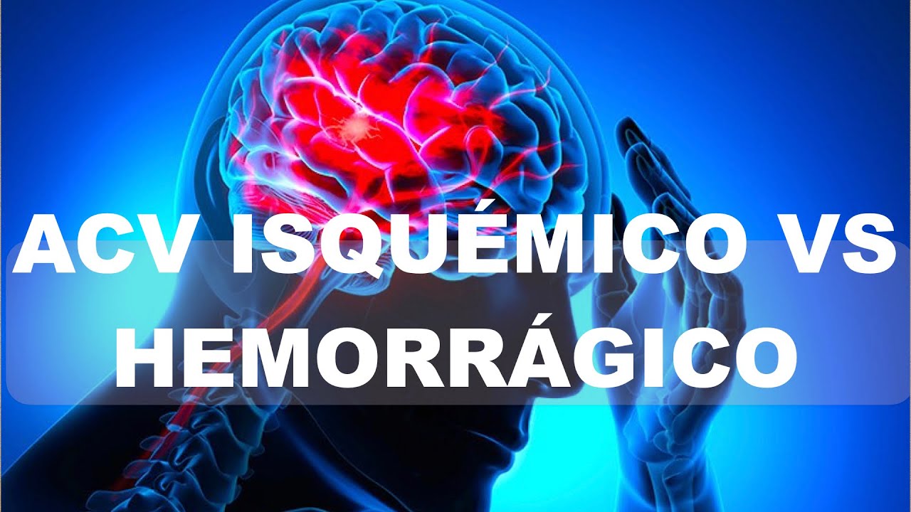 ACV Isquémico vs Hemorrágico. Diferencias