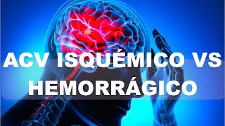 ACV Isquémico vs Hemorrágico. Diferencias
