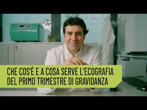 Nicola Volpe-7