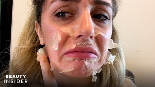 What It’s Like To Get A Chemical Peel For Acne Scars | Beauty Explorers