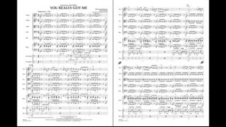 You Really Got Me Now by Ray Davies/arr. James Kazik