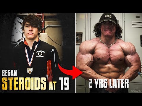 Sam Sulek DANGEROUS Dive Into STEROID Abuse