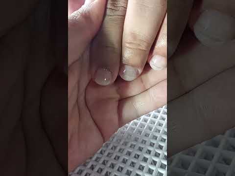 RESULTADO MARAVILHOSO😍💅