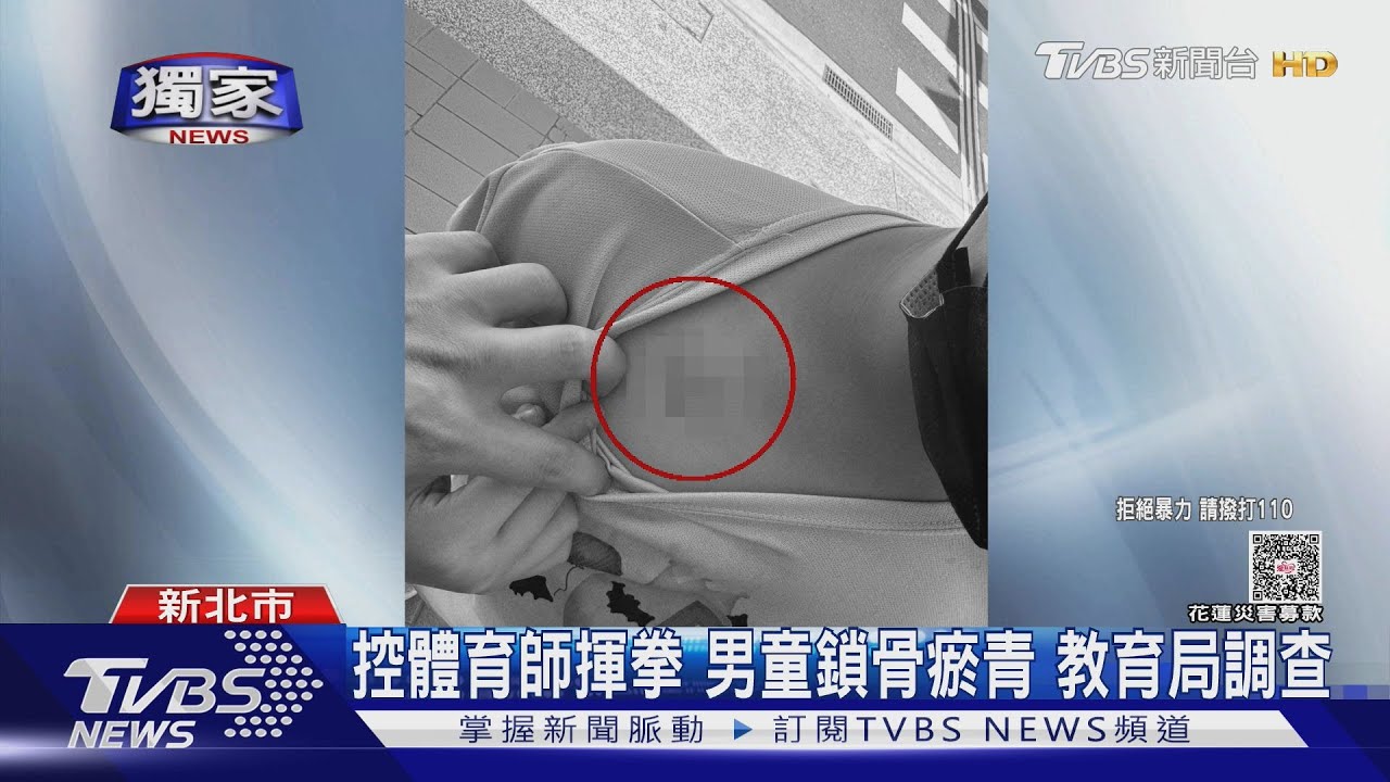 獨/控體育師拳打國小生「鎖骨瘀青」 老師竟說「讓你打回來」