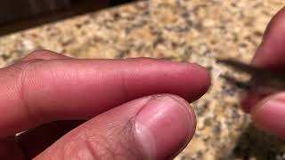 REMOVING AN INVISIBLE SPLINTER - HOW TO