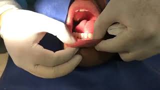 Raspado y alisado radicular con nuestros estudiantes #PeriodonciaUNAM