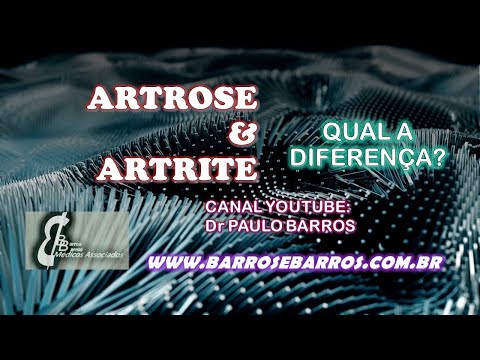 Artrite e Artrose
