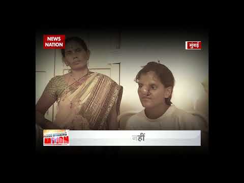 Khabar Achi Hai: 500-year old Tagliacozzi method helps 18-year-old get her nose back