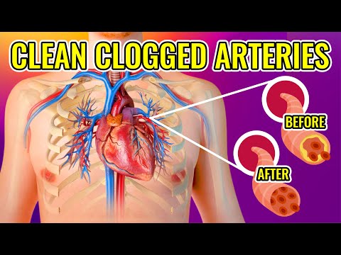 , title : '15 Foods that Can Save Your Life: How to Prevent Arteriosclerosis | Unclog Your Arteries'