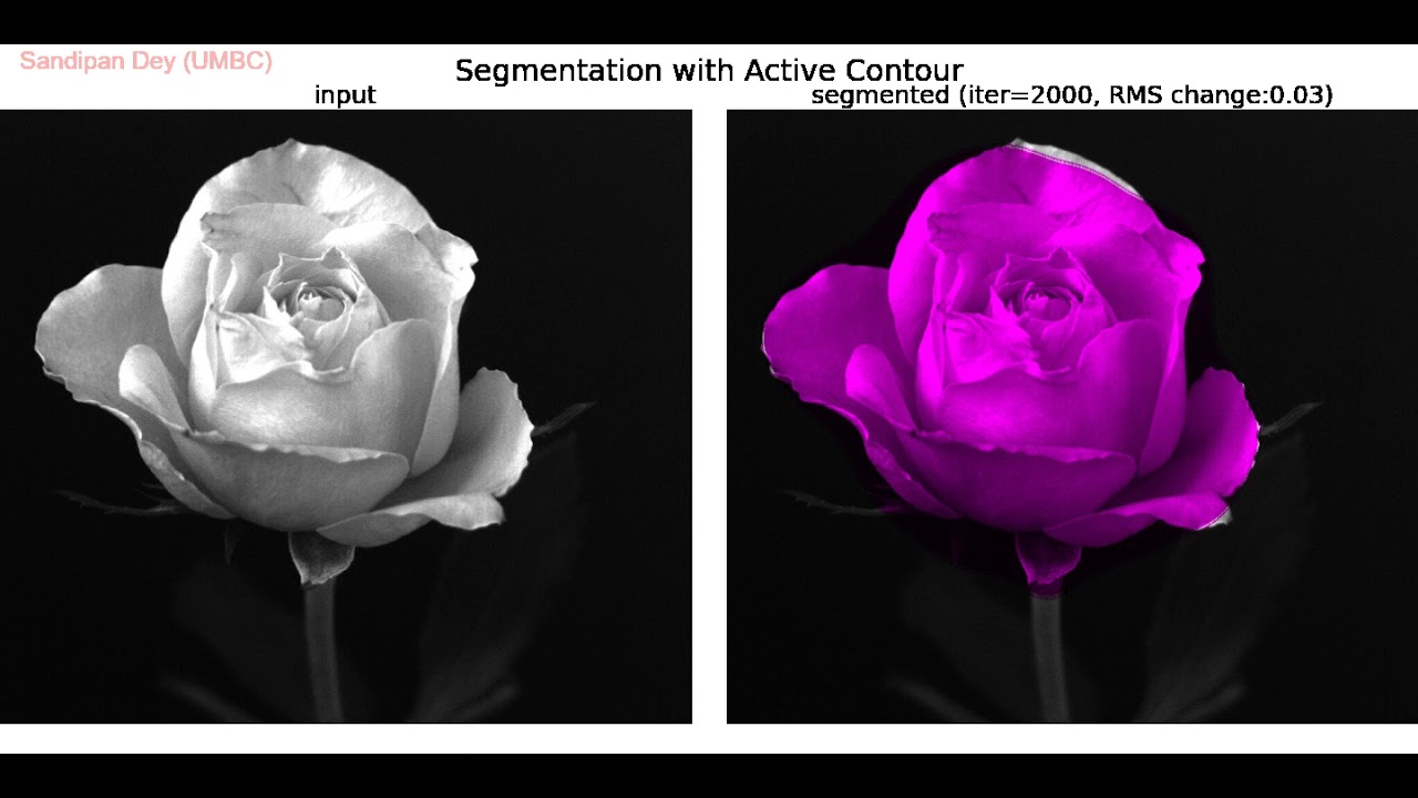 Image Segmentation | Active Contours | SimpleITK | Python