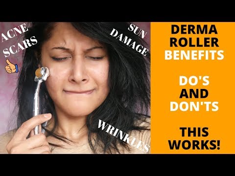 HOW TO USE A DERMA ROLLER | CORRECT METHOD | 10 MICRONEEDLING SIDE EFFECTS & THE RIGHT SIZE Video