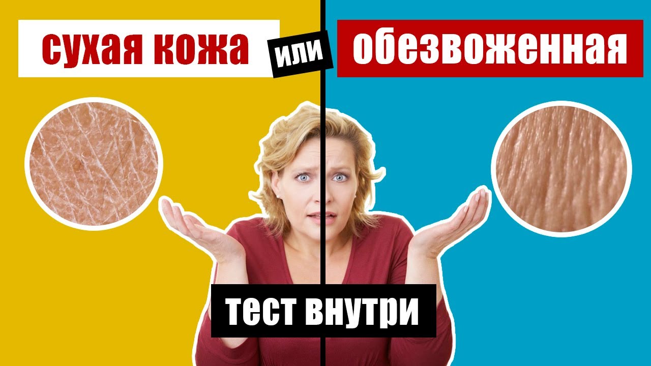Сухая кожа - причины и правильный физиологический уход за кожей. Здоровьесберегающий канал