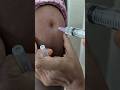 IM injection veyadam ela#intramuscular injection#arm injection#doctor#medical#pharmacy#trendingshort
