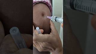 Download lagu IM injection veyadam ela#intramuscular injection#arm injection#doctor#medical#pharmacy#trendingshort mp3 Download lagu IM injection veyadam ela#intramuscular injection#arm injection#doctor#medical#pharmacy#trendingshort mp3