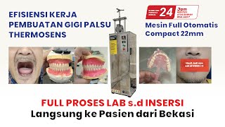 Download lagu Proses Pembuatan Gigi Palsu Full Rahang Atas Bawah Pasien dari Bekasi 24 jam bisa Jadi ???!!!! mp3