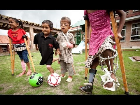 Helping Children Walk, Run & Thrive: Child Amputees & Children with Limb Disabilities