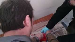 Eugene Spender Head Autopsy