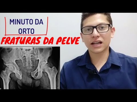 Pelvic Fractures - Ortho Minute | Physio in Motion