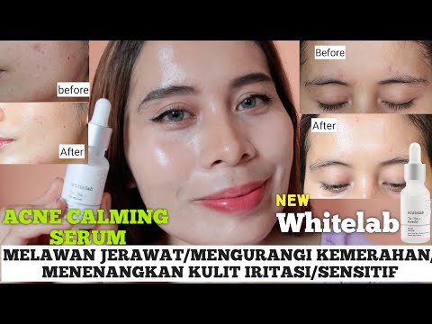 white lab acne serum