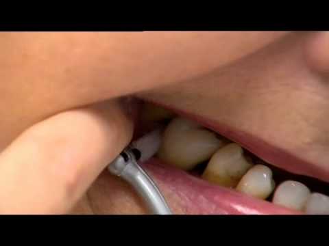 YouTube video Pe4SFuackYk