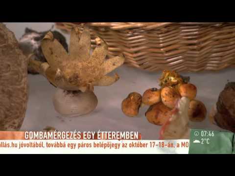 nemi szemölcsök eltávolító krém fülöp-szigetek kövér gyöngyök