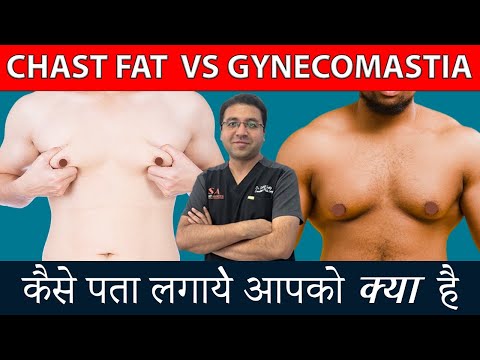 Difference between Chest Fat and Gynecomastia  Chest Fat vs Gyno