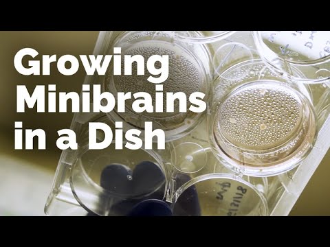 Growing Minibrains In a Dish