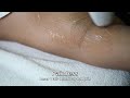 LHR Butt Armpits Brazilian G