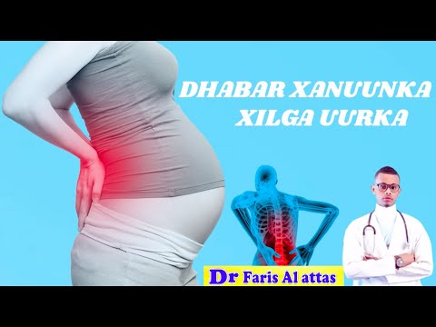 JOOJI DHABAR XANUUNKA XILIGA UURKA. Drfaris