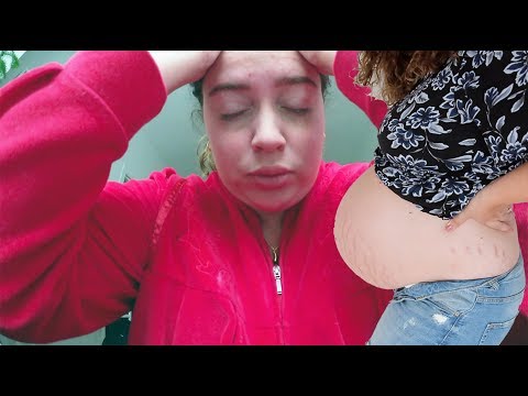 FÖRLOSSNINGEN OCH FRUKTANSVÄRDA SMÄRTOR - GRAVID UPPDATERING V38