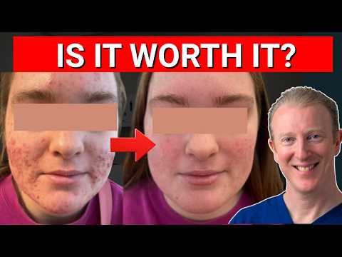 ACCUTOP 20MG CAPSULES