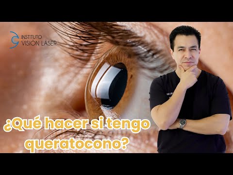¿Qué hago si tengo Queratocono?