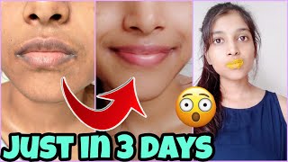How I get rid of Pigmented lips 👄  REAL LIP CARE ROUTINE changes my lip colour