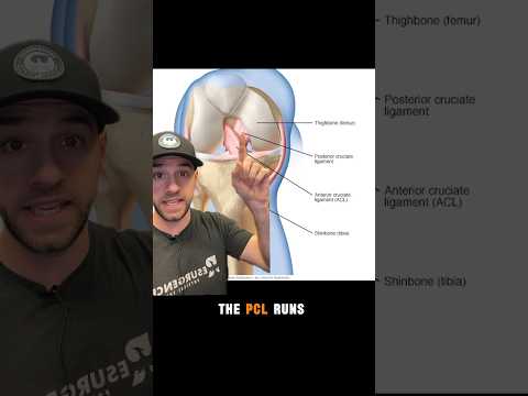 PCL Injury - Posterior Drawer Test #PCL #dashboardinjury #kneeinjury #sportsinjury