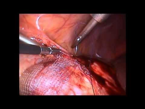 YouTube Трейлер