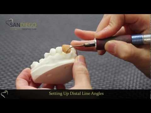 Dental Lab in San Diego