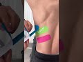 How to tape a broken or injured rib with kinesiology tape to relieve pain