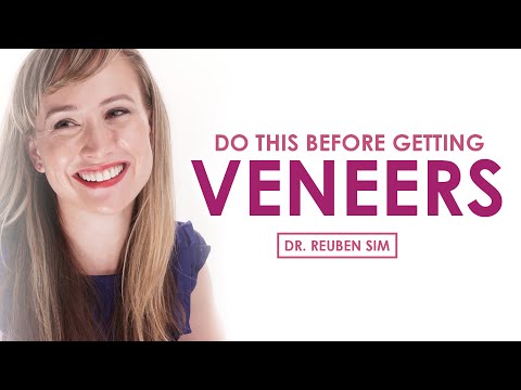 Do This Before Getting Veneers | You Won't Regret It