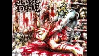 Severe Torture   Meant to Suffer vocal cover