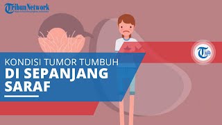 Neurofibromatosis Tipe 1, Kondisi Genetik yang Menyebabkan Tumor Tumbuh di Sepanjang Saraf