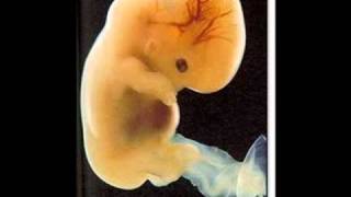 Save The BABIES. music by Anna Graceman (Lexi's Lullaby)