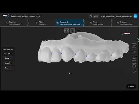 Mark Interproximal Peaks (Maxilla)
