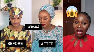 😱Viral Nigerian Bride Has a Black Eye on Her Big Day: Accident or DV?