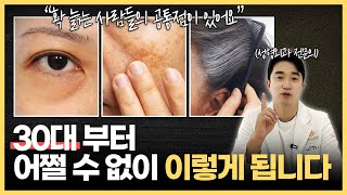 30대 얼굴, 예외 없이 다 이렇게 망가집니다