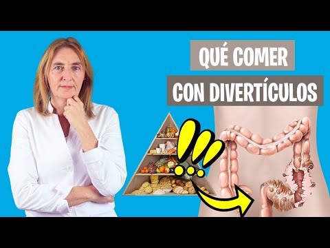 La MEJOR DIETA para PERSONAS con DIVERTÍCULOS | Lo que comer con divertículos | Nutrición clínica